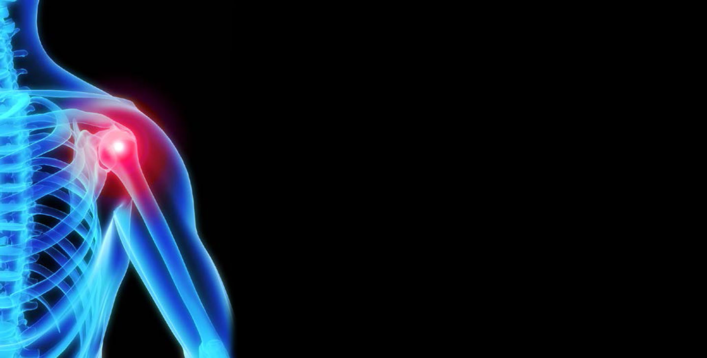 a skeleton with a red spot on the shoulder