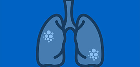 blue and black lungs