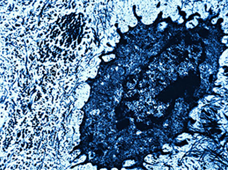 a close-up of a blue blot